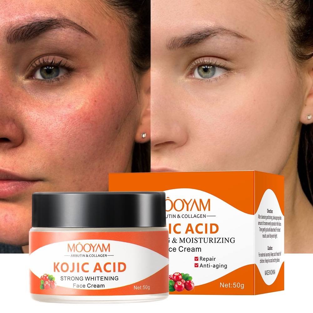 img_1617 KOJIC ACID STRONG WHITENING FACE CREAM - Image 1